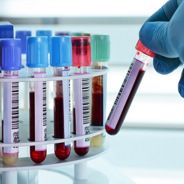 a person holding test tube with blood test