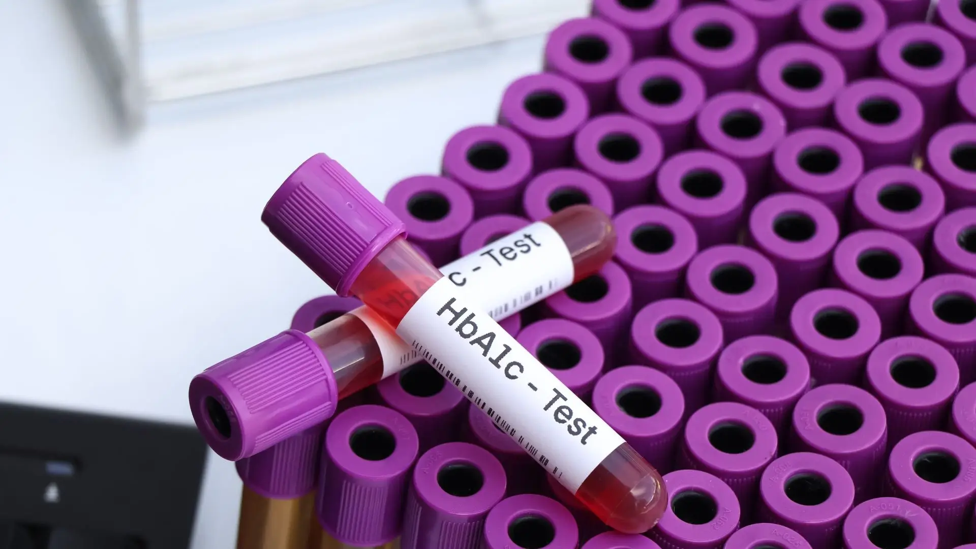 HbA1c (Sugar) test near me