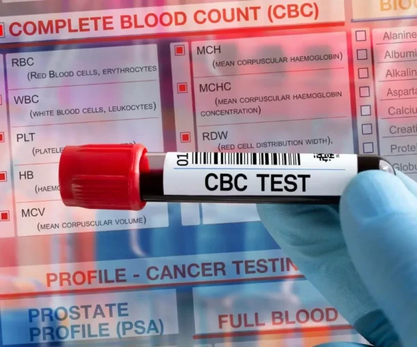CBC Test