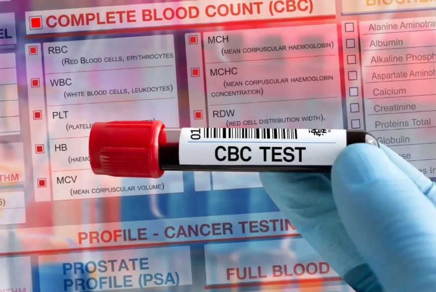 CBC Test