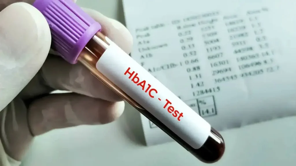 HBA1C Test