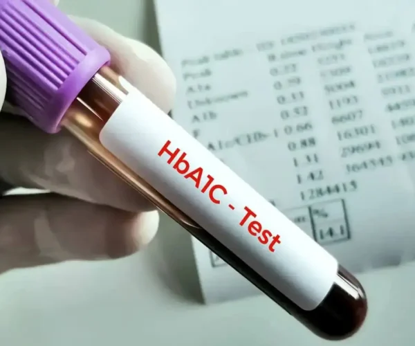 HBA1C Test
