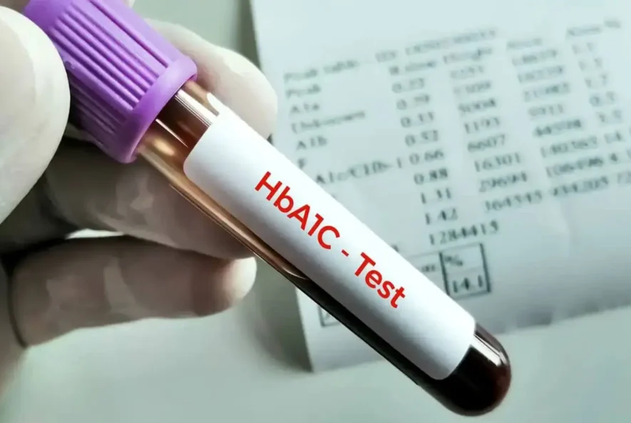 HBA1C Test
