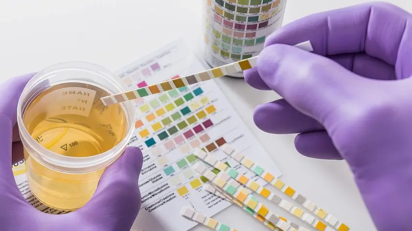 Urine Test in Lahore