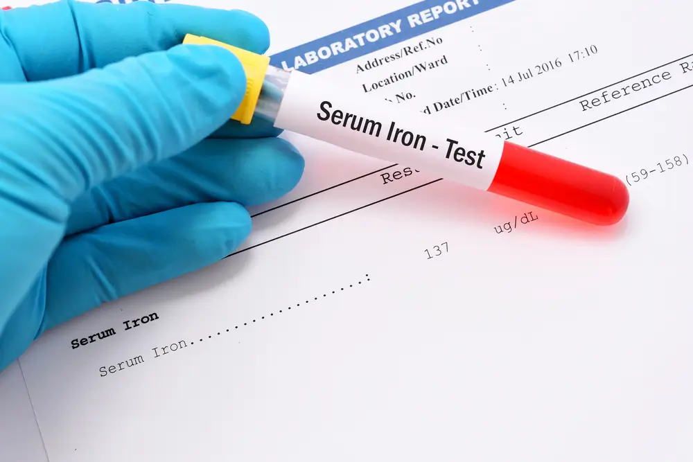 Iron test