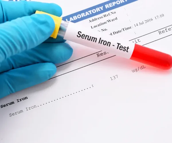 Serum Iron Test