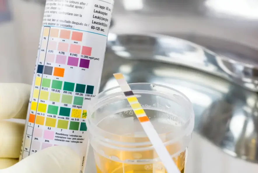 Urine Test