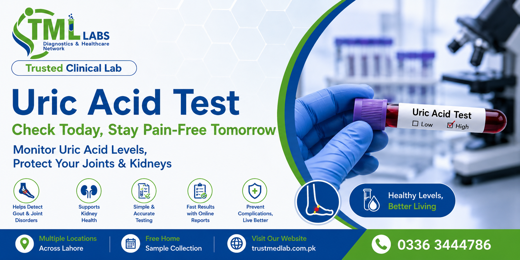 uric acid test include